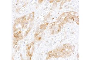 Immunohistochemistry (IHC) image for anti-Aryl Hydrocarbon Receptor (AHR) (AA 798-848) antibody (ABIN7453955)