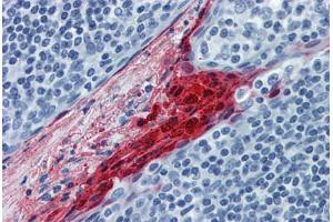 anti-Small Proline-Rich Protein 3 (SPRR3) (AA 1-162) antibody