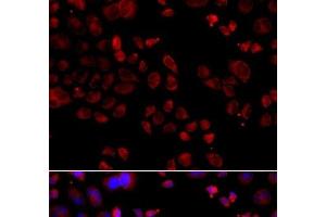 Immunofluorescence analysis of A549 cells using SLC22A11 Polyclonal Antibody (SLC22A11 anticorps)
