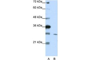 WB Suggested Anti-ZNF397 Antibody Titration:  1.