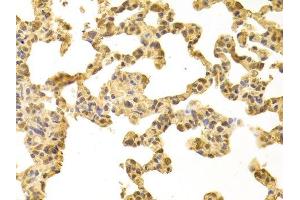 Immunohistochemistry of paraffin-embedded rat lung using PPP4C antibody. (PPP4C anticorps  (AA 1-307))