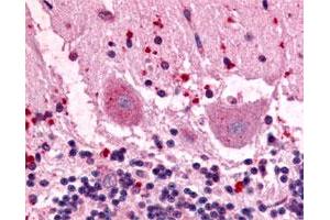 Immunohistochemical (Formalin/PFA-fixed paraffin-embedded sections) staining of human brain with GPR3 polyclonal antibody . (GPR3 anticorps)