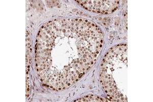 Immunohistochemical staining of human testis with THYN1 polyclonal antibody  shows strong nuclear positivity in subsets of cells in seminiferus ducts at 1:200-1:500 dilution. (THYN1 anticorps)