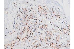ABIN6267364 at 1/200 staining Human heart tissue sections by IHC-P.