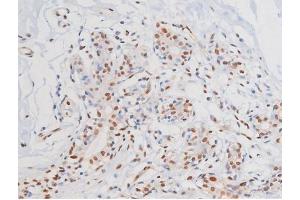 ABIN6267364 at 1/200 staining Human heart tissue sections by IHC-P. (KIT anticorps  (pTyr703))