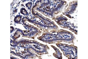 IHC analysis of TRIM16 using anti-TRIM16 antibody (ABIN7602226). (TRIM16 anticorps  (AA 65-210))