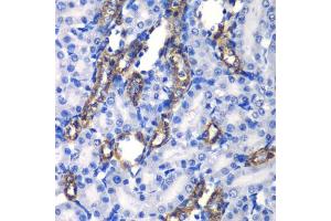 Immunohistochemistry of paraffin-embedded rat kidney using MATK antibody  at dilution of 1:100 (40x lens).
