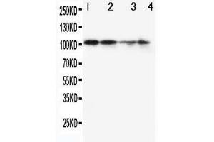 Anti-MCM2 antibody, Western blotting Lane 1: SW620 Cell Lysate Lane 2: PANC Cell Lysate Lane 3: JURKAT Cell Lysate Lane 4: HELA Cell Lysate (MCM2 anticorps  (C-Term))