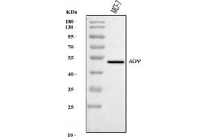 Western blot analysis of PAP/ACP3 using anti-PAP/ACP3 antibody (ABIN7600122).