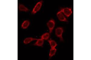 ABIN6266979 staining HeLa by IF/ICC. (GK2 anticorps  (Internal Region))