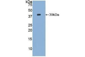 Detection of Recombinant CVL, Human using Polyclonal Antibody to Ezrin (EZR) (Ezrin anticorps  (AA 1-295))