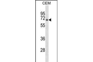ACCN3 Antibody (N-term) (ABIN1539468 and ABIN2838152) western blot analysis in CEM cell line lysates (35 μg/lane). (ASIC3 anticorps  (N-Term))