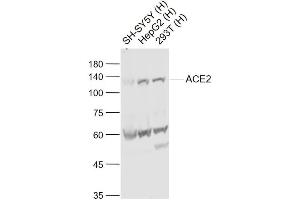 Lane 1: SH-SY5Y cell lysates; Lane 2: HepG2 cell lysates; Lane 3: 293T cell lysates probed with ACE2 Polyclonal Antibody, Unconjugated (bs-23444R) at 1:1000 dilution and 4˚C overnight incubation.