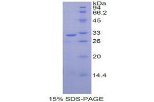 SDS-PAGE (SDS) image for NADPH Oxidase 1 (NOX1) (AA 235-488) protein (His tag) (ABIN1878113) (NOX1 Protein (AA 235-488) (His tag))