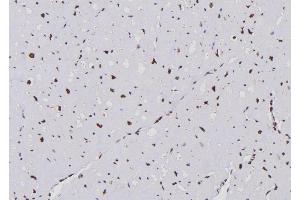 ABIN6259987 and ABIN6276683 at 1/100 staining Human heart tissue by IHC-P. (APOBEC3G anticorps  (C-Term))