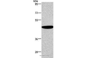 Western blot analysis of Human fetal brain tissue, using ABI1 Polyclonal Antibody at dilution of 1:300 (ABI1 anticorps)