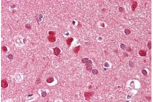 Image no. 2 for anti-Zinc Finger, FYVE Domain Containing 1 (ZFYVE1) (AA 650-699) antibody (ABIN6749748)