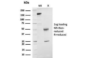 SDS-PAGE Analysis Purified ER-beta Mouse Monoclonal Antibody (ESR2/3207). (ESR2 anticorps)