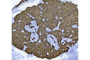 IHC analysis of GLB1/Beta-galactosidase using anti-GLB1/Beta-galactosidase antibody (ABIN7601806). (GLB1 anticorps  (AA 46-655))