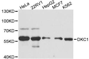 Western blot analysis of extracts of various cell lines, using DKC1 antibody. (DKC1 anticorps)