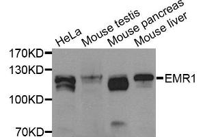Western blot analysis of Jurkat cell lysate using EMR1 antibody.