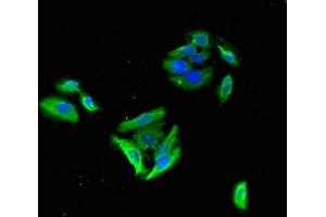 Immunofluorescent analysis of HepG2 cells using ABIN7153497 at dilution of 1:100 and Alexa Fluor 488-congugated AffiniPure Goat Anti-Rabbit IgG(H+L)