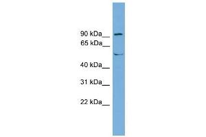 TEC antibody used at 1 ug/ml to detect target protein.