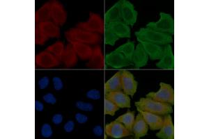 ABIN6266262 and ABIN6277409 staining Hela cells(30 min of UV treatment) by IF/ICC.