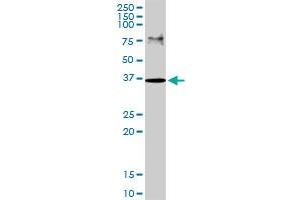 RLBP1 MaxPab rabbit polyclonal antibody. (RLBP1 anticorps  (AA 1-317))