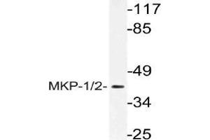 Western blot (WB) analysis of MKP-1/2 antibody in extracts from Jurkat cells. (DUSP1 anticorps)