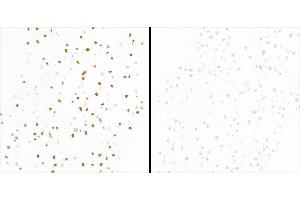anti-Tripartite Motif Containing 28 (TRIM28) (pSer824) antibody