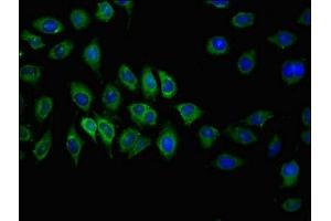 Immunofluorescent analysis of A549 cells using ABIN7146636 at dilution of 1:100 and Alexa Fluor 488-congugated AffiniPure Goat Anti-Rabbit IgG(H+L) (ABCC2 anticorps  (AA 724-947))