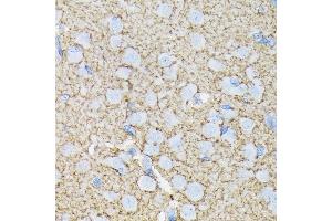 Immunohistochemistry of paraffin-embedded rat brain using E/SLC1 Rabbit mAb (ABIN7270394) at dilution of 1:100 (40x lens).