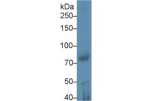 Western Blot; Sample: Rat Testis lysate; Primary Ab: 1µg/ml Rabbit Anti-Mouse iPLA2 Antibody Second Ab: 0. (PLA2G6 anticorps  (AA 481-702))
