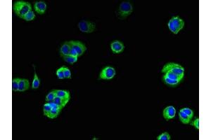 Immunofluorescent analysis of MCF-7 cells using ABIN7173155 at dilution of 1:100 and Alexa Fluor 488-congugated AffiniPure Goat Anti-Rabbit IgG(H+L)
