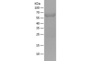Western Blotting (WB) image for Inhibitor of kappa Light Polypeptide Gene Enhancer in B-Cells, Kinase gamma (IKBKG) (AA 120-419) protein (His-IF2DI Tag) (ABIN7123432)