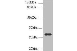 Western blot All lanes: UTP23 antibody at 7 μg/mL + Mouse liver tissue Secondary Goat polyclonal to rabbit IgG at 1/10000 dilution Predicted band size: 29, 17 kDa Observed band size: 29 kDa