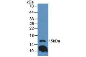 Western blot analysis of Mouse Lung Tissue. (IL1F9 anticorps  (AA 5-149))