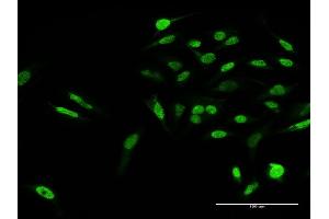 Immunofluorescence of purified MaxPab antibody to KLF15 on HeLa cell. (KLF15 anticorps  (AA 1-416))