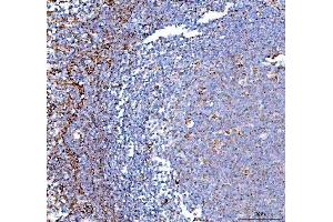 IHC analysis of PPA2 using anti-PPA2 antibody (ABIN6719431). (PPA2 anticorps  (AA 33-334))
