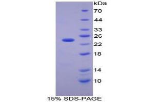 SDS-PAGE analysis of Mouse Carbonic Anhydrase I Protein.