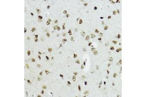 Immunohistochemistry of paraffin-embedded mouse brain using Acetyl-Histone H3-K27 antibody (ABIN7267670) at dilution of 1:200 (40x lens).