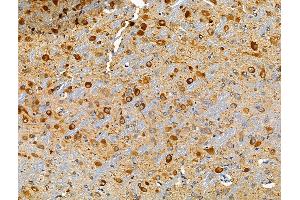 ABIN6259592 and ABIN6274950 at 1/100 staining Rat brain tissue by IHC-P.