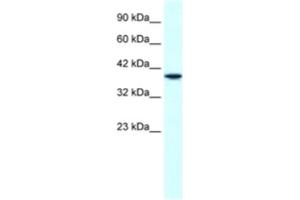 Western Blotting (WB) image for anti-H6 Family Homeobox 1 (HMX1) antibody (ABIN2460518) (HMX1 anticorps)