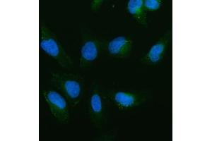 IF analysis of cIAP1/BIRC2 using anti-cIAP1/BIRC2 antibody (ABIN5693185).