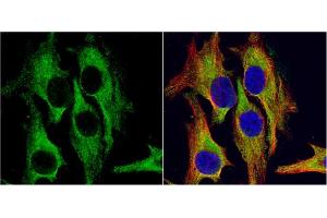 ICC/IF Image HSD11B1 antibody detects HSD11B1 protein at cytoplasm by immunofluorescent analysis.