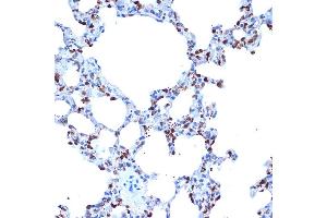 Immunohistochemistry of paraffin-embedded rat lung using  Rabbit mAb (ABIN7265434) at dilution of 1:100 (40x lens).