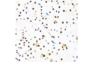 Immunohistochemistry of paraffin-embedded mouse brain using FUBP1 antibody at dilution of 1:100 (x40 lens). (FUBP1 anticorps)