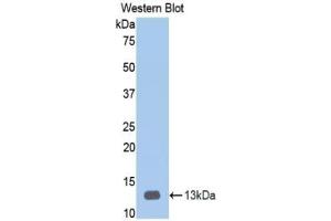 Detection of Recombinant HPA, Human using Polyclonal Antibody to Heparanase (HPSE)
