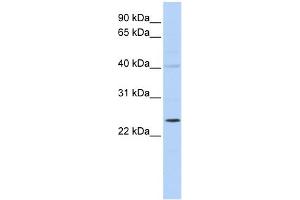 WB Suggested Anti-KCNIP2 Antibody Titration:  0. (KCNIP2 anticorps  (N-Term))